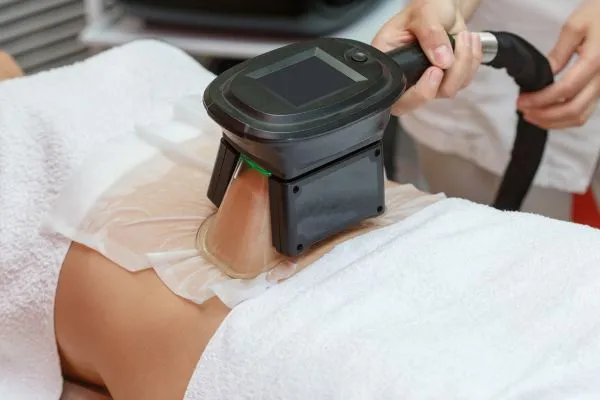 Image of person having fat freezing treatment to help weight gain Basildon