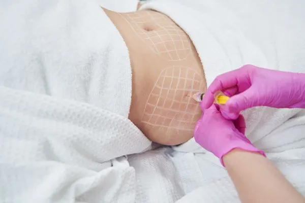 image of fat dissolving injections on love handles to help combat weight gain Basildon