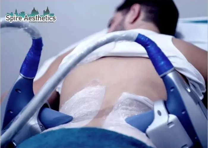 Man having fat freezing treatment done on love handles before a competitions Basildon to create a sculpted look.