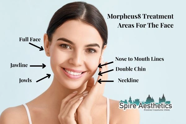 Where can Morpheus8 Treatment Basildon be done on the body?